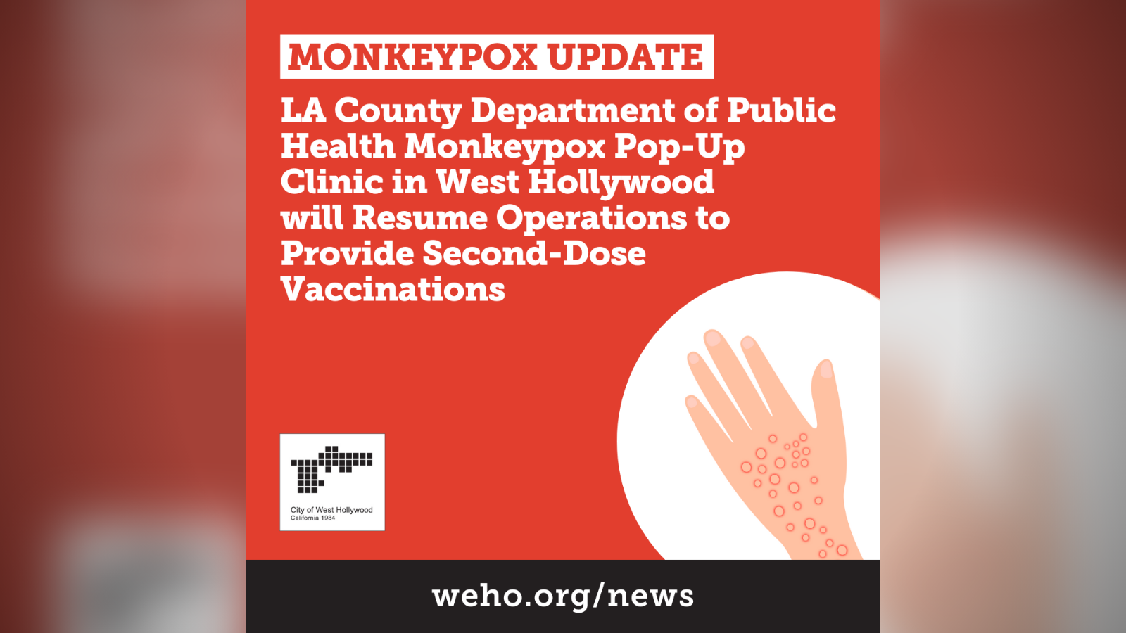 Monkeypox Update Pop-Up Clinic to Resume in West Hollywood