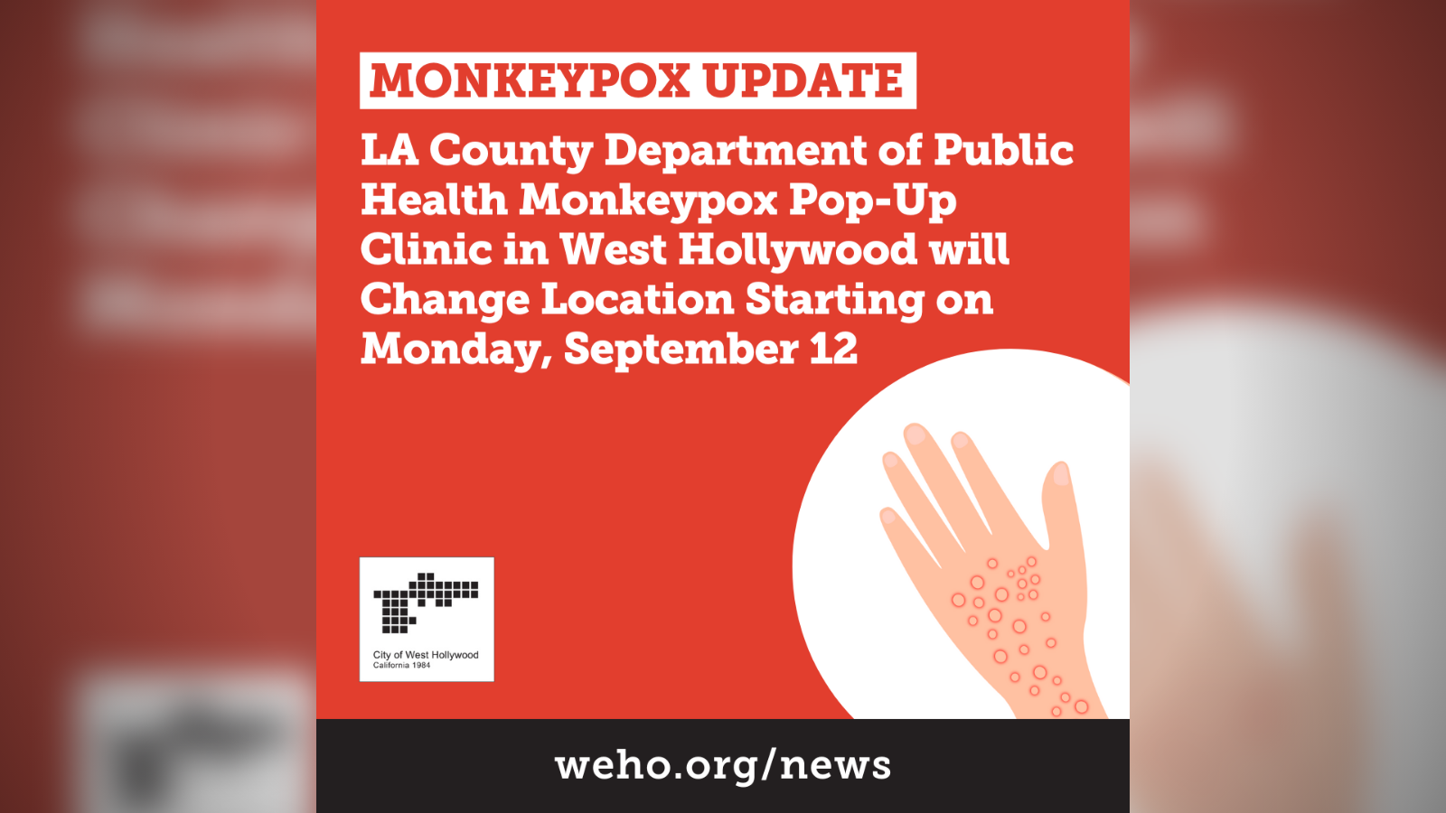 Monkeypox Update Pop-Up Clinic Change of Location